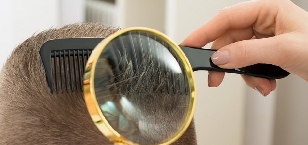 Cara Menghilangkan Kutu Rambut